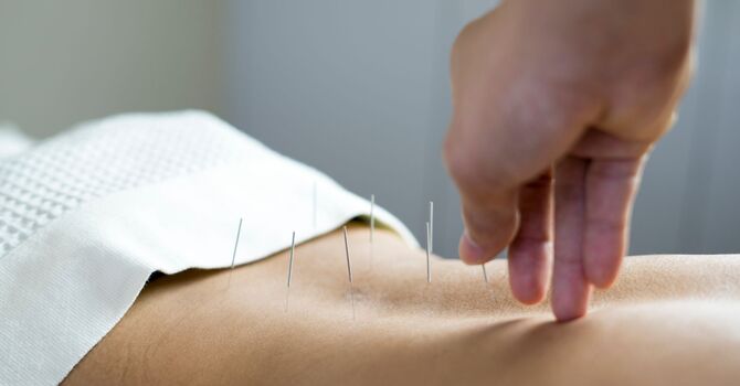 Demystifying Acupuncture A Patients Guide image