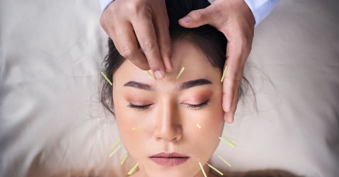 Acupuncture: A Practical Guide