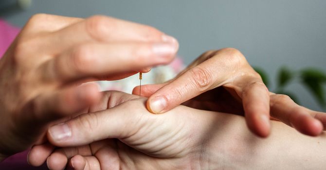 Demystifying Acupuncture A Patients Guide